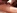 Chatte poilue et seins silicons